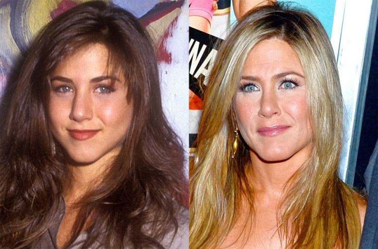 Năm 2007, Jennifer Aniston thực hiện ca phẫu thuật nâng mũi đầu tiên và lý do cô đưa ra là cô bị một quả bóng chày rơi trúng mặt khiến vách ngăn mũi bị lệch và phải phẫu thuật lại mũi. Ai cũng công nhận, nhờ phẫu thuật mũi mà trông khuôn mặt của cô thon gọn hơn. Năm 2011, Jennifer lại chỉnh sửa mũi lần nữa để hoàn thiện lại những chỗ chưa hoàn hảo của lần phẫu thuật đầu.